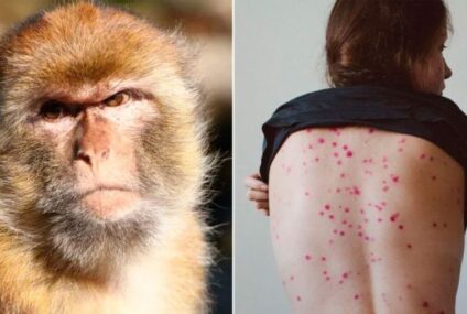 La OMS aconseja «no hacer una montaña de un grano de arena» con el brote de viruela del mono mientras aumentan los casos: ¿habrá una nueva pandemia?
