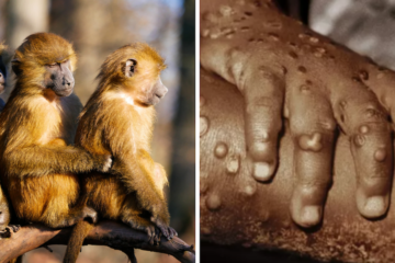 Autoridades detectan casos de viruela del mono en Norteamérica y Europa