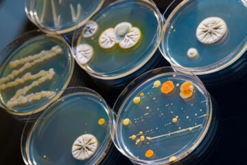 EU alerta sobre mortífera bacteria «devoradora carne» en aguas del Atlántico y el Golfo de México
