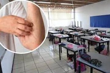 Suspenden clases en telesecundaria de Comitán por casos sospechosos de sarampión